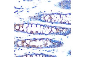 Immunohistochemistry of paraffin-embedded human colon using BMP4 Rabbit mAb (ABIN7265898) at dilution of 1:100 (40x lens). (BMP4 anticorps)