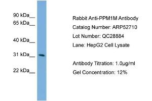WB Suggested Anti-PPM1M  Antibody Titration: 0. (PPM1M anticorps  (Middle Region))