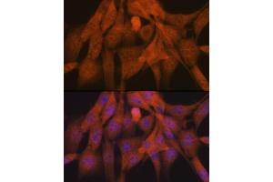 Immunofluorescence analysis of NIH-3T3 cells using K48-linkage Specific Ubiquitin Rabbit mAb (ABIN1680189, ABIN3017871, ABIN3017872 and ABIN7101530) at dilution of 1:100 (40x lens). (Ubiquitin B anticorps)