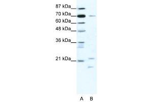 BTF3 antibody (20R-1189) used at 0. (BTF3 anticorps  (Middle Region))