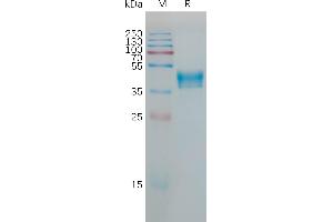 Human HC Protein, hFc Tag on SDS-PAGE under reducing condition. (HCRTR1 Protein (AA 1-46) (Fc Tag))