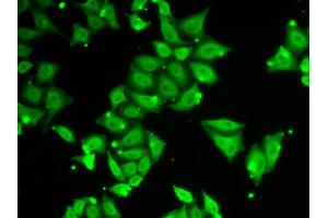 Immunofluorescence analysis of HeLa cells using ATXN3 antibody (ABIN5970585). (Ataxin 3 anticorps)