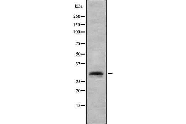 RIMS4 anticorps  (N-Term)