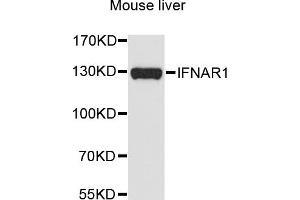 Western blot analysis of extracts of mouse liver, using IFNAR1 antibody (ABIN5970858) at 1/1000 dilution. (IFNAR1 anticorps)