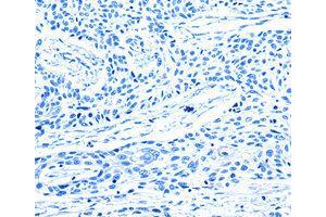 Immunohistochemistry (IHC) image for anti-G Protein-Coupled Receptor Kinase 1 (GRK1) antibody (ABIN1872898) (GRK1 anticorps)