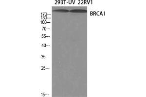 Western Blotting (WB) image for anti-Breast Cancer 1 (BRCA1) (Ser1423) antibody (ABIN5959016) (BRCA1 anticorps  (Ser1423))