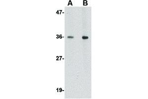 Western Blot of BRAL1 Antibody Western Blot of BRAL1 antibody. (HAPLN2 anticorps  (Internal Region))