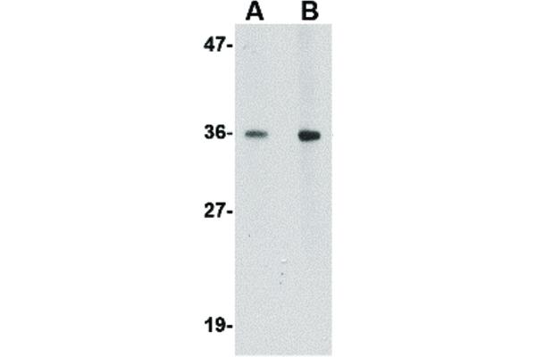 HAPLN2 anticorps  (Internal Region)