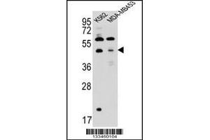 Western blot analysis in K562,MDA-MB453 cell line lysates (35ug/lane). (SNX29 anticorps  (C-Term))