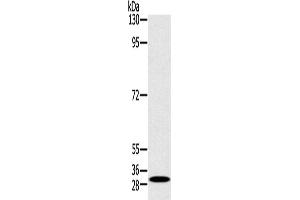 Western Blotting (WB) image for anti-RAB27A, Member RAS Oncogene Family (RAB27A) antibody (ABIN2430690) (RAB27A anticorps)