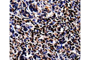 Immunohistochemistry (IHC) image for anti-S100 Calcium Binding Protein A4 (S100A4) antibody (ABIN2420928) (s100a4 anticorps)