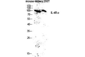 Western blot analysis of Mouse-kidney, 293T lysate using IL-4Rα antibody. (IL4 Receptor anticorps)