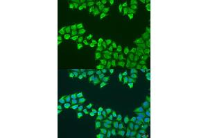 Immunofluorescence analysis of U2OS cells using ATP5F1 antibody (ABIN2736327) at dilution of 1:100. (ATP5F1 anticorps)