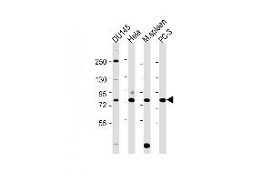 Western Blotting (WB) image for anti-Synovial Apoptosis Inhibitor 1, Synoviolin (SYVN1) (AA 586-617), (C-Term) antibody (ABIN388980)