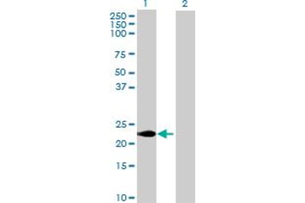 CABP7 anticorps  (AA 1-215)