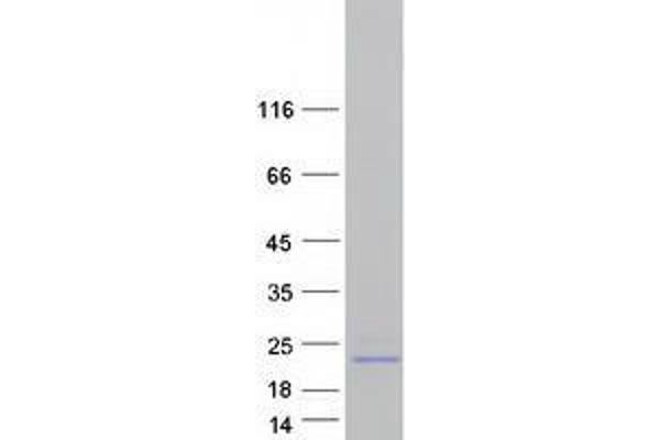 Vasopressin Protein (Myc-DYKDDDDK Tag)