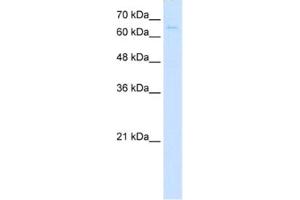 Western Blotting (WB) image for anti-CTP Synthase (CTPS) antibody (ABIN2462931) (CTP Synthase anticorps)