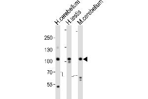 Western blot analysis of lysates from human cerebellum, human testis, mouse cerebellum tissue lysate (from left to right), using SKOR2 Antibody (C-term) (ABIN6244147 and ABIN6577773). (SKOR2 anticorps  (C-Term))