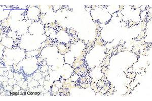 Immunohistochemical analysis of paraffin-embedded rat lung tissue. (JAK1 anticorps  (pTyr1022))