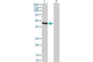 Western Blot analysis of VIL1 expression in transfected 293T cell line by VIL1 MaxPab polyclonal antibody. (Villin 1 anticorps  (AA 1-421))