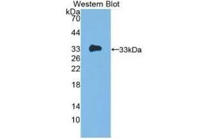 Detection of Recombinant IL12A, Human using Monoclonal Antibody to Interleukin 12A (IL12A) (IL12A anticorps  (AA 23-219))