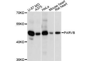 Western blot analysis of extracts of various cell lines, using PARVB antibody (ABIN6290187) at 1:3000 dilution. (Parvin, beta anticorps)