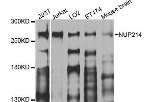 Western blot analysis of extracts of various cell lines, using NUP214 antibody (ABIN5974670) at 1/1000 dilution. (NUP214 anticorps)