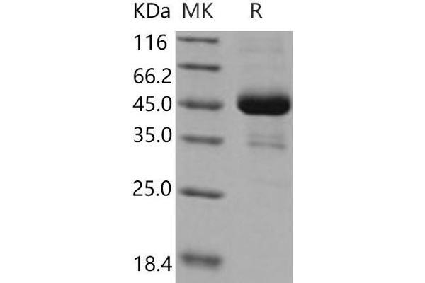 ACVR1 Protein (His tag,Fc Tag)