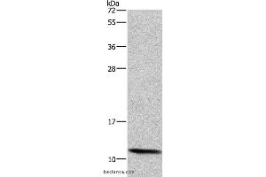 Western blot analysis of HepG2 cell, using HSPE1 Polyclonal Antibody at dilution of 1:750 (HSPE1 anticorps)