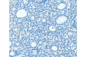 Immunohistochemistry (IHC) image for anti-Neurogenin 3 (NEUROG3) antibody (ABIN1873885) (Neurogenin 3 anticorps)