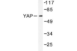 Image no. 1 for anti-Yes-Associated Protein 1 (YAP1) antibody (ABIN272105) (YAP1 anticorps)