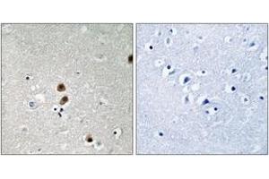Immunohistochemistry analysis of paraffin-embedded human brain, using CtBP1 (Phospho-Ser422) Antibody. (CTBP1 anticorps  (pSer422))
