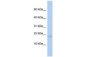 RFESD antibody used at 1 ug/ml to detect target protein. (RFESD anticorps)