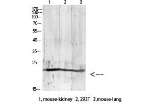 Western blot analysis of RAT-brain lysate, antibody was diluted at 1:1000. (GREM2 anticorps  (AA 71-120))