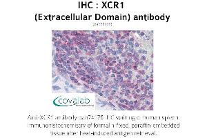Image no. 1 for anti-Chemokine (C Motif) Receptor 1 (XCR1) (3rd Extracellular Domain) antibody (ABIN1740868) (XCR1 anticorps  (3rd Extracellular Domain))