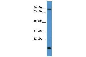 App antibody used at 0. (APP anticorps  (C-Term))