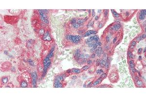 Immunohistochemistry of paraffin-embedded Placenta tissue using CD151 Polyclonal Antibody at dilution of 1:120. (CD151 anticorps)