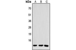 Western blot analysis of CCL26 expression in HEK293T (A), NS-1 (B), H9C2 (C) whole cell lysates. (CCL26 anticorps  (Center))