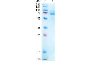 P2RX7 Protein (Fc Tag)