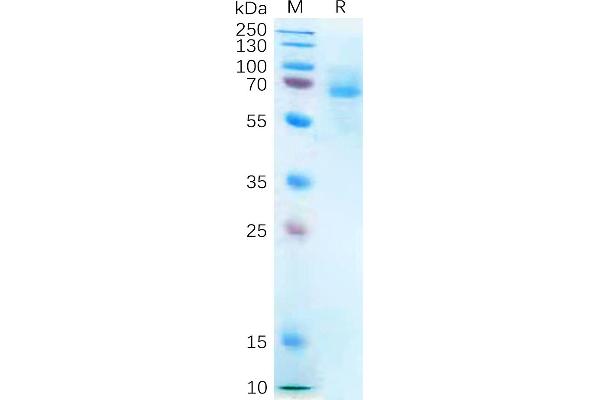 P2RX7 Protein (Fc Tag)