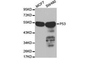 Western Blotting (WB) image for anti-Tumor Protein P53 (TP53) antibody (ABIN1875167) (p53 anticorps)