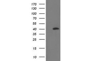 HEK293T cells were transfected with the pCMV6-ENTRY control (Left lane) or pCMV6-ENTRY RLBP1 (Right lane) cDNA for 48 hrs and lysed. (RLBP1 anticorps)