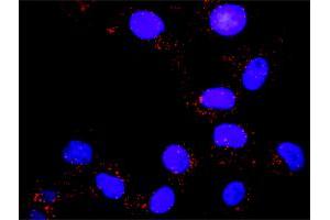 Proximity Ligation Assay (PLA) image for anti-Phosphoinositide 3 Kinase, p85 alpha (PI3K p85a) (AA 1-454) antibody (ABIN518903)