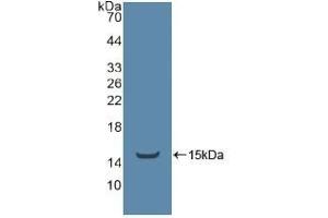 Detection of Recombinant ADRbK1, Human using Polyclonal Antibody to TEK Tyrosine Kinase, Endothelial (Tie2) (TEK anticorps  (AA 1-116))