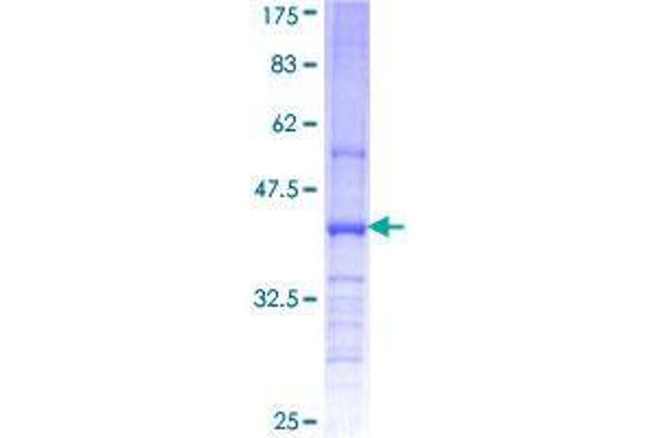 CHST11 Protein (AA 230-337) (GST tag)