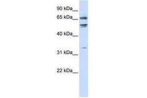 Image no. 1 for anti-Mediator Complex Subunit 26 (MED26) (N-Term) antibody (ABIN6742775) (MED26 anticorps  (N-Term))