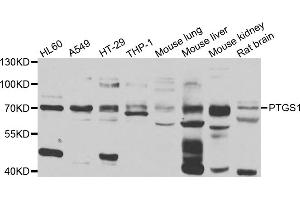 Western blot analysis of extracts of various cell lines, using PTGS1 antibody (ABIN4904895) at 1:1000 dilution. (PTGS1 anticorps)