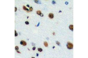 Immunohistochemical analysis of CstF-64T staining in human brain formalin fixed paraffin embedded tissue section. (CstF-64T anticorps)