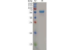 Human PGF Protein, hFc Tag on SDS-PAGE under reducing condition. (PLGF Protein (AA 19-170) (Fc Tag))