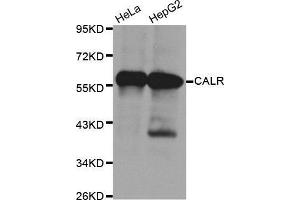 Western Blotting (WB) image for anti-Calreticulin (CALR) antibody (ABIN6214923) (Calreticulin anticorps)